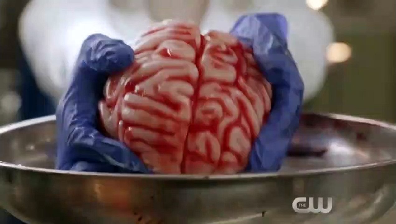iZombie - saison 2 - épisode 2 Teaser VO