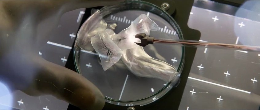 Life - Origine Inconnue EXTRAIT VF Mutilation