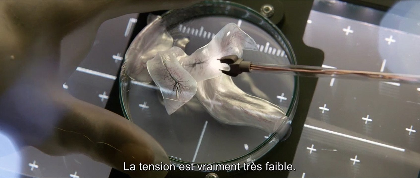 Life - Origine Inconnue EXTRAIT VO "Mutilation"