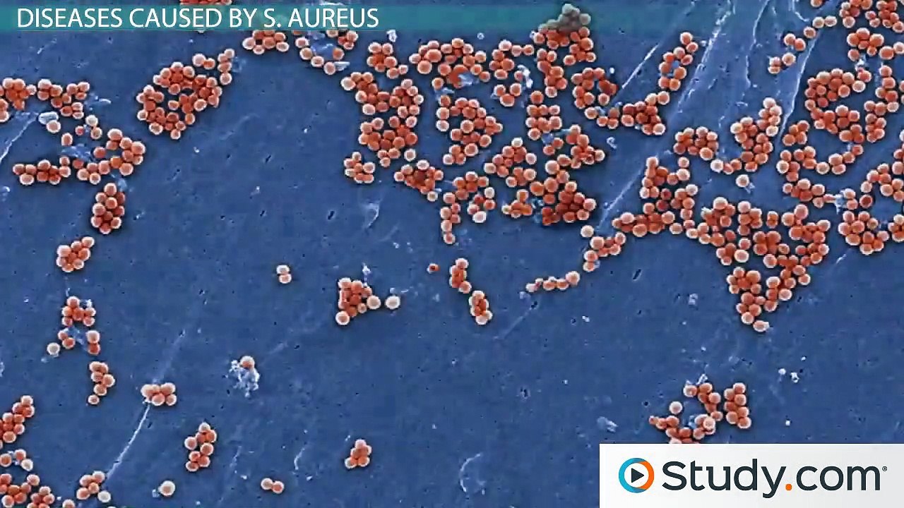 What Is a Staph Infection- - Causes, Symptoms & Treatments