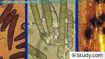 What Is Diphtheria- - Cause, Symptoms & Treatments