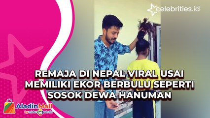 Remaja di Nepal Viral Usai Memiliki Ekor Berbulu Seperti Sosok Dewa Hanuman