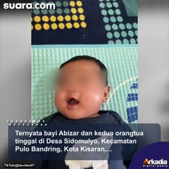 Viral! Bayi 3 Bulan di Sumut Sudah Bisa Bicara