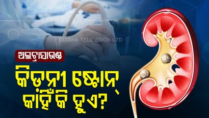 Kidney Stones, Its Diagnosis And Treatment