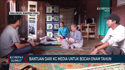 Amora, Bocah 6 Tahun yang Alami Luka Bakar di Simalungun Terima Bantuan