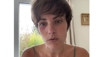 Diane Wattrelos atteinte de la "maladie du suicide" : "C'est une maladie atroce. À 26 ans, j’ai dû faire mon testament "