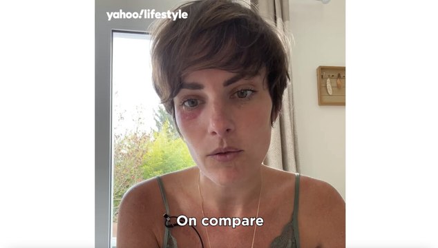 C’est une des pires douleurs que l’on puisse ressentir : les symptômes de la maladie du suicide