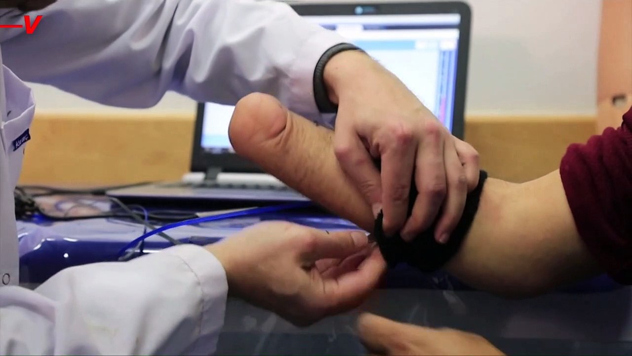 These Bionic ‘Smart’ Limbs Are Giving Amputees in Gaza a New Lease on Life