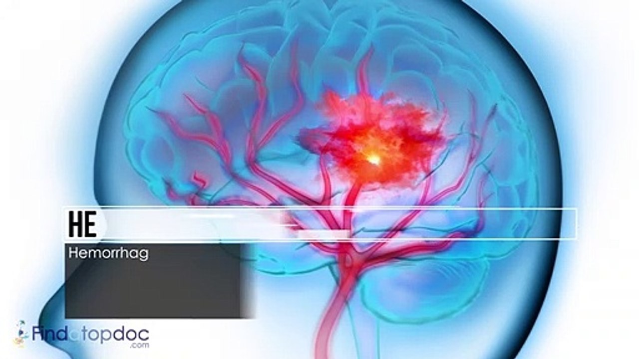 Status Epilepticus Causes | FindaTopDoc