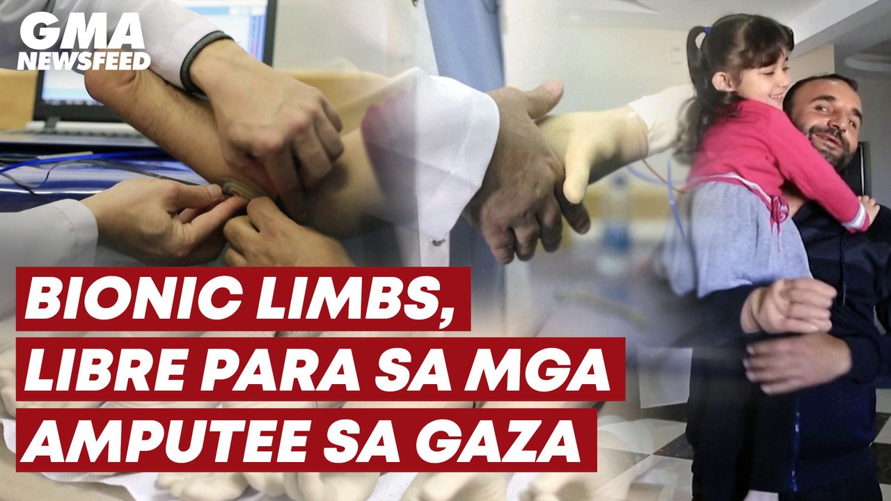 Bionic limbs, libre para sa mga amputee sa Gaza | GMA News Feed