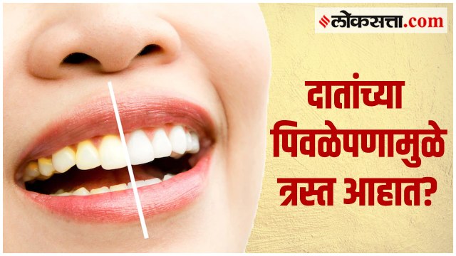 दातांच्या पिवळेपणापासुन ‘या’ ५ घरगुती उपायांनी मिळेल सुटका