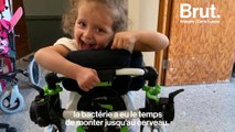 E.coli : le quotidien de Giulia, 4 ans, handicapée à plus de 80 %