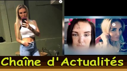 Marie Garet (Secret Story) défigurée : les terribles photos de ce drame qui a gâché sa vie