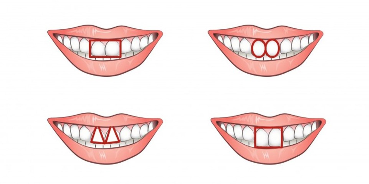 Voilà ce que la forme de vos dents révèle de votre personnalité
