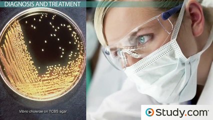 Cholera- Causes, Treatment and Prevention