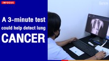 A 3-minute test could help detect lung cancer | The Nation