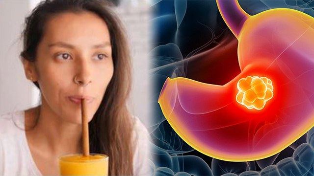 आम और दूध मिलाकर पीने से क्या होता है | Aam Aur Dudh Milakar Peene Se Kya Hota Hai | Boldsky