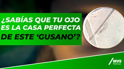 ¿Sabías que tu ojo es la casa perfecta de este gusano? Es milimétrico y podrías no notarlo