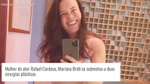 Mariana Bridi passa por mudanças no corpo após emagrecimento e realiza cirurgias plásticas. Saiba onde!