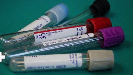 News Top Santé - L'actualité Santé