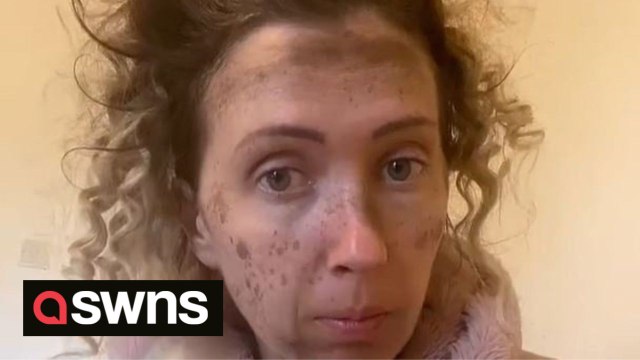 UK mum copies TikTok trend to create fake freckles but was left looking like she 'stuck her head up a chimney'