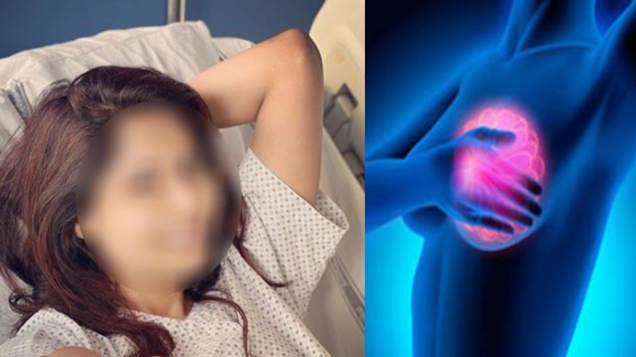 Chhavi Mittal की Breast Cancer Surgery, ब्रेस्ट कैंसर सर्जरी में क्या होता है | Boldsky