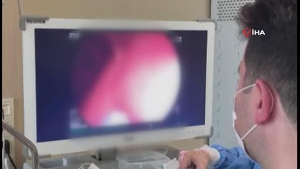 Obezite de yeni yöntem 'Mide Botoksu'