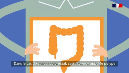 Le cancer colorectal : pourquoi se faire dépister ?