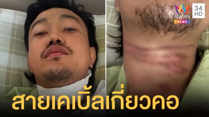 สายเคเบิ้ลเกี่ยว จยย.พุ่งอัดเสาไฟฟ้า หนุ่มเจ็บสาหัส | ข่าวเที่ยงอมรินทร์ | 26 เม.ย.65
