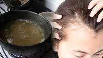 माथे के बाल झड़ने पर क्या करें | Forehead Hair Growth Naturally | Boldsky