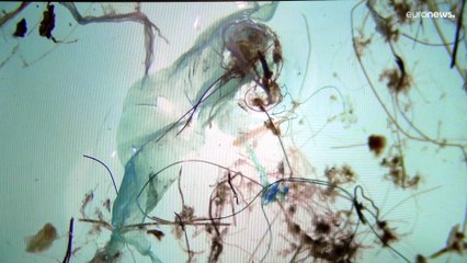 "Les microplastiques se retrouvent dans le sang humain", les scientifiques alertent