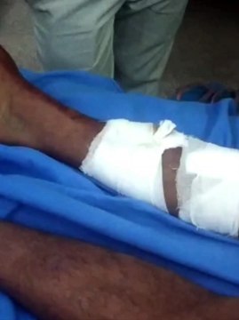 बाइक सवार को कार से मारी टक्कर, फिर हमला कर लूटे तीन लाख व आभूषण