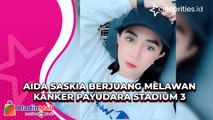 Aida Saskia Berjuang Melawan Kanker Payudara Stadium 3