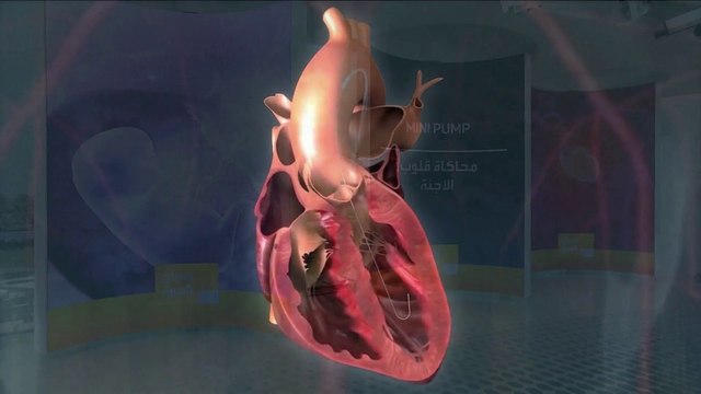 صباح العربية | تطوير قلب اصطناعي ينبض من تلقاء نفسه