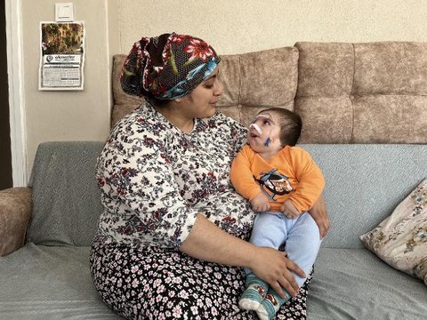NADİR GÖRÜLEN 'GOLDENHAR SENDROMU' İLE DÜNYAYA GELEN ASIM BEBEK, AMELİYAT OLMAYI BEKLİYOR
