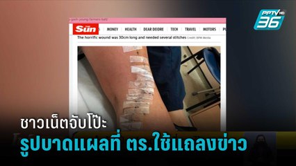 ชาวเน็ตจับโป๊ะรูปบาดแผลที่ ตร.ใช้แถลงข่าว | โชว์ข่าวเช้านี้