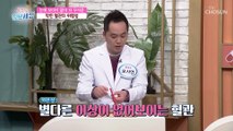 혈관도 살이 찐다?! 지방과 노폐물이 쌓이는 혈관 비만 TV CHOSUN 220428 방송