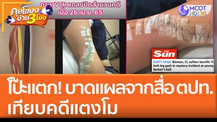 โป๊ะแตก! บาดแผลจากสื่อต่างประเทศ เทียบคดีแตงโม (28 เม.ย. 65) คุยโขมงบ่าย 3 โมง