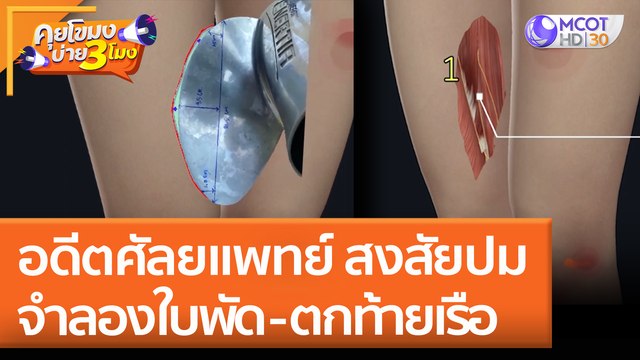 อดีตศัลยแพทย์ สงสัยปมจำลองใบพัด - ตกท้ายเรือ (28 เม.ย. 65) คุยโขมงบ่าย 3 โมง