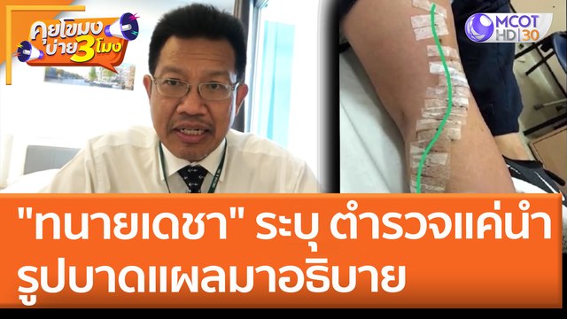 ทนายเดชา ระบุ ตำรวจแค่นำรูปบาดแผลมาอธิบาย (28 เม.ย. 65) คุยโขมงบ่าย 3 โมง