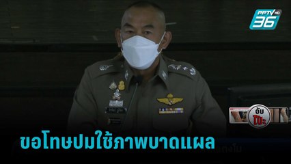 ตร. ขอโทษปมใช้ภาพบาดแผลเทียบคดีแตงโม | เข้มข่าวค่ำ
