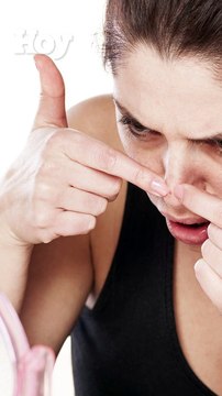 Pasión por los granos: ¿Por qué nos encanta explotar espinillas?