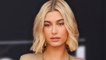 Hailey Bieber Reveals She Had A Hole In Her Heart Closed After Terrifying Stroke: Video