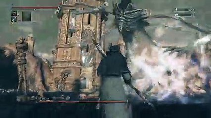 Bloodborne Amygdala