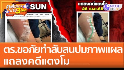 ตำรวจขอภัยทำสับสน "ปมภาพแผล" แถลงคดีแตงโม (29 เม.ย. 65) คุยโขมงบ่าย 3 โมง