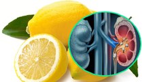 Kidney Stone का इलाज Lemon से हो सकता है क्या ? । Lemon Can Cure Kidney Stone | Boldsky
