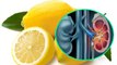 Kidney Stone का इलाज Lemon से हो सकता है क्या ? । Lemon Can Cure Kidney Stone | Boldsky