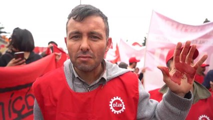 Ankara'daki 1 Mayıs Kutlamasında Arbede: "Telsizlerle Vurup Kafamızı Yardılar"