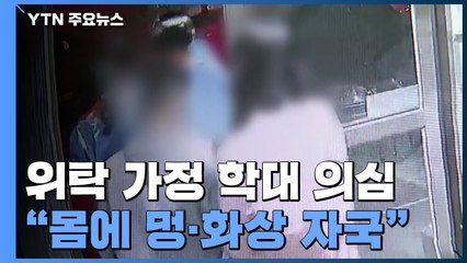 입양 전 위탁 가정에서 13개월 남아 숨져..."멍·화상 자국, 학대 의심" / YTN