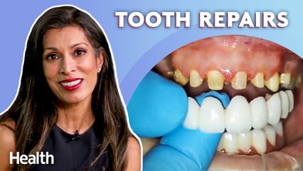 Periodontist Answers YOUR Questions About Abscesses, Missing Teeth, and Veneers